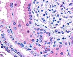 Goat anti-RNF213 / C17orf27 (C Terminus) Antibody