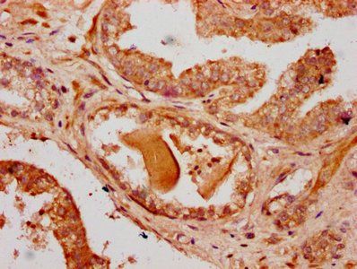 RNF220 Antibody