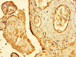 RNF4 Antibody