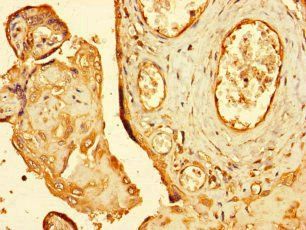 RNF4 antibody