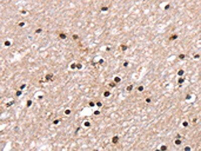 RNF40 Antibody