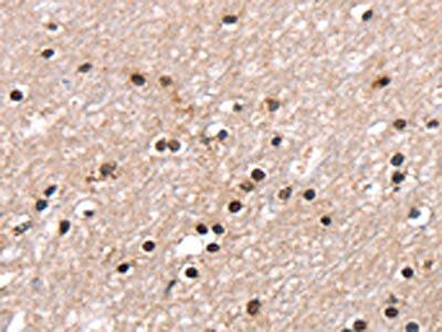 RNF40 antibody