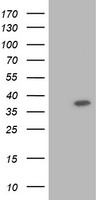 RNF86 (TRIM2) antibody