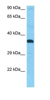 RNH2B antibody