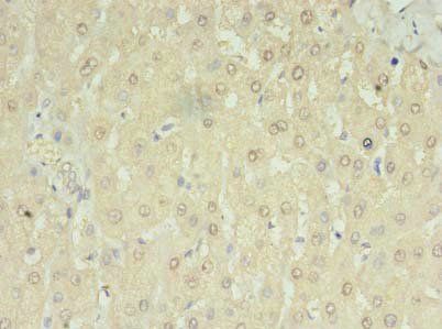 MRM3 Antibody