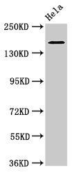 ROBO1 antibody