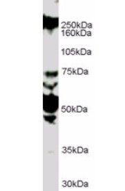 Goat anti-ROBO1 / DUTT1 (Internal) Antibody