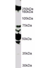 ROBO1 antibody