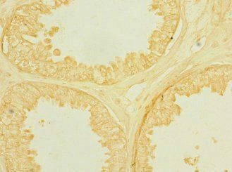 ROBO2 Antibody