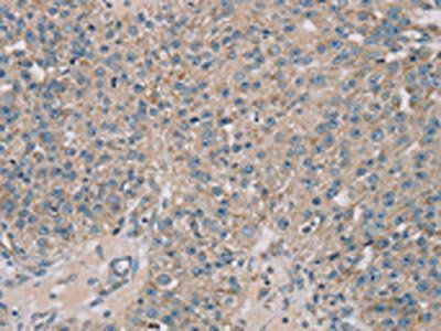 ROBO2 Antibody