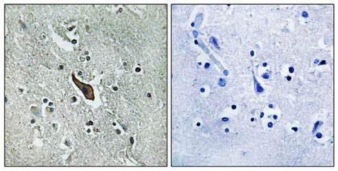 ROBO2 antibody