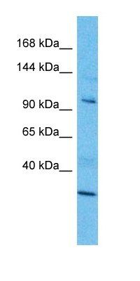 ROBO3 antibody