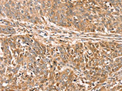 ROBO3 Antibody