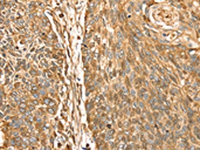ROBO3 Antibody