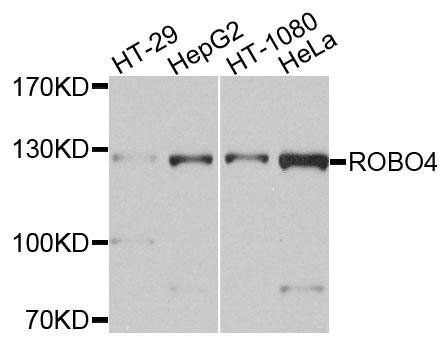 ROBO4 antibody