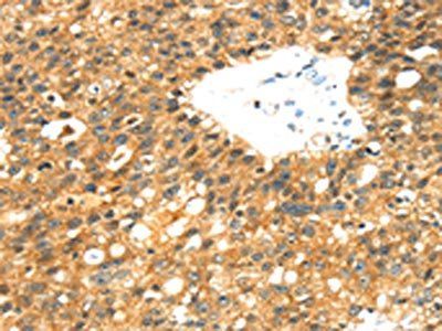 ROBO4 Antibody