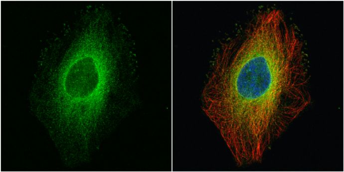 ROCK1 antibody