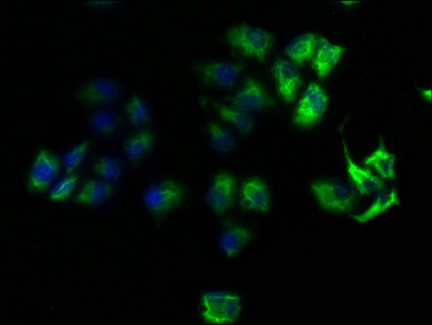 ROCK1 antibody