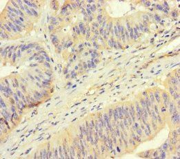 ROPN1 Antibody
