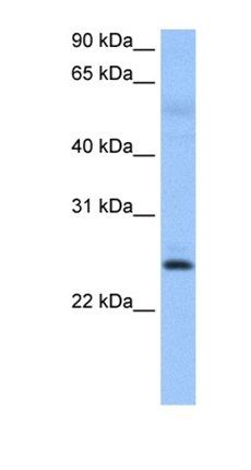 ROPN1B antibody