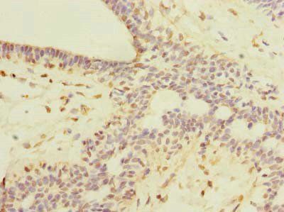 ROPN1L Antibody
