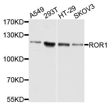 ROR1 antibody