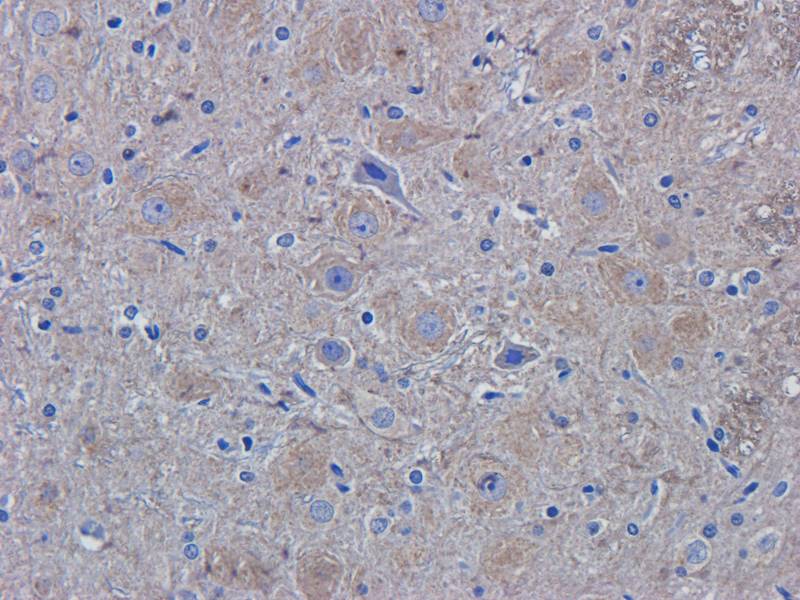 ROR1 antibody