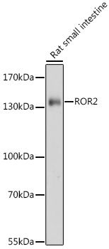 ROR2 antibody