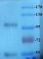 ROR2 antibody