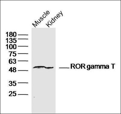 ROR gamma T antibody