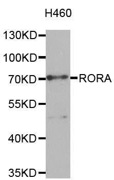 RORA antibody