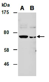 RORA (C) Antibody, Rabbit Polyclonal