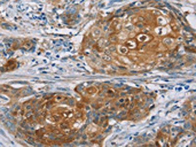 RORB Antibody