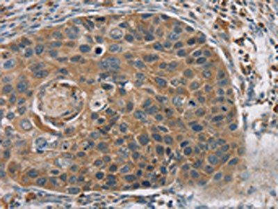 RORB Antibody