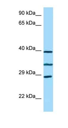 RP9 antibody