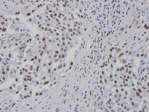 RPA14 Rabbit Polyclonal Antibody