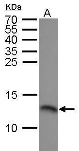 RPA14 Rabbit Polyclonal Antibody