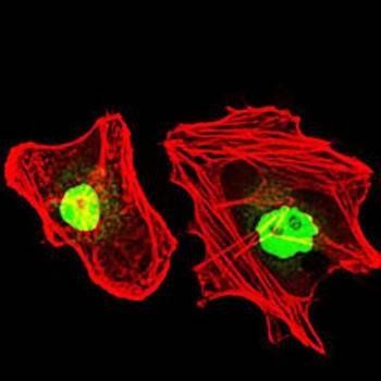 RPA1 Antibody