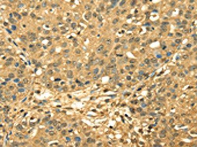 RPA2 Antibody