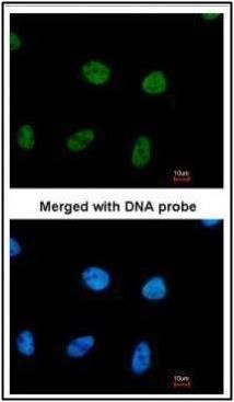 RPA32 Rabbit Polyclonal Antibody