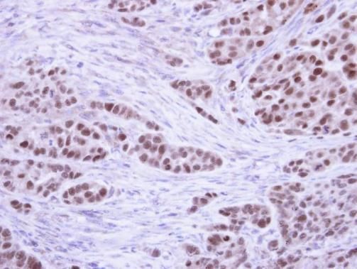 RPA32 Rabbit Polyclonal Antibody