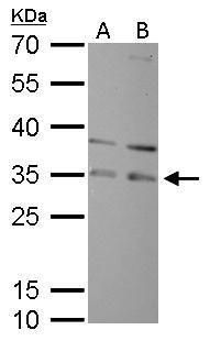 RPA32 Rabbit Polyclonal Antibody