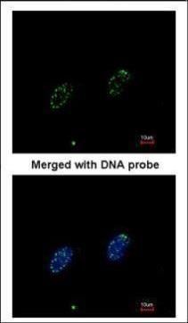 RPA70 antibody