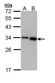RPA 32 kDa subunit antibody