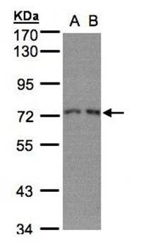RPA 70 kDa subunit antibody