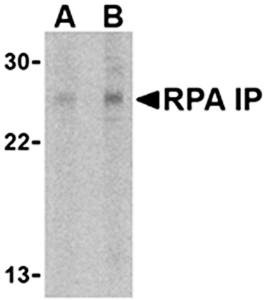 RPA Interacting Protein Antibody