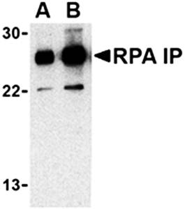 RPA Interacting Protein Antibody