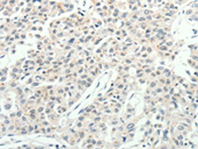 RPAP3 antibody