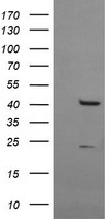 RPC62 (POLR3C) antibody