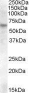 Goat anti-RPE65 Antibody